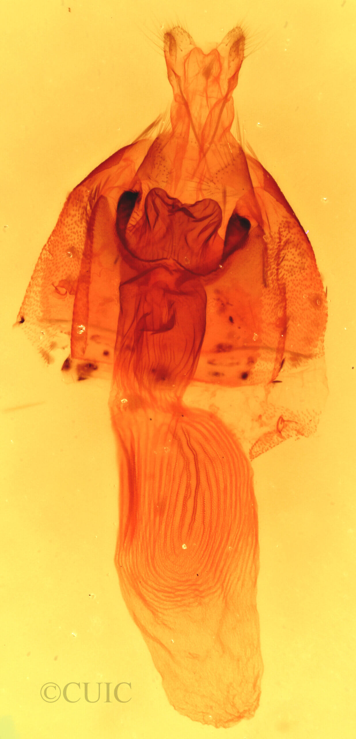 genitalia view of adult Galgula partita