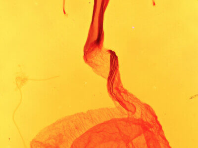 genitalia view of adult Dypterygia patina