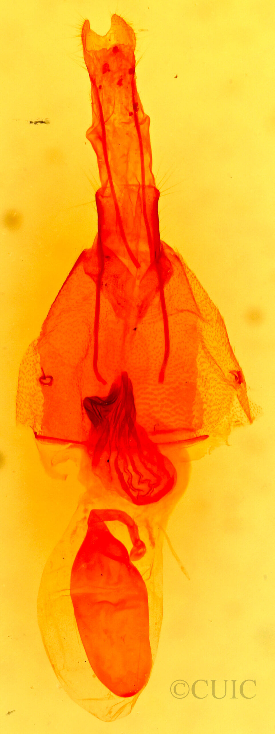 genitalia view of adult Micrathetis triplex