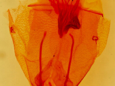 genitalia view of adult Micrathetis triplex