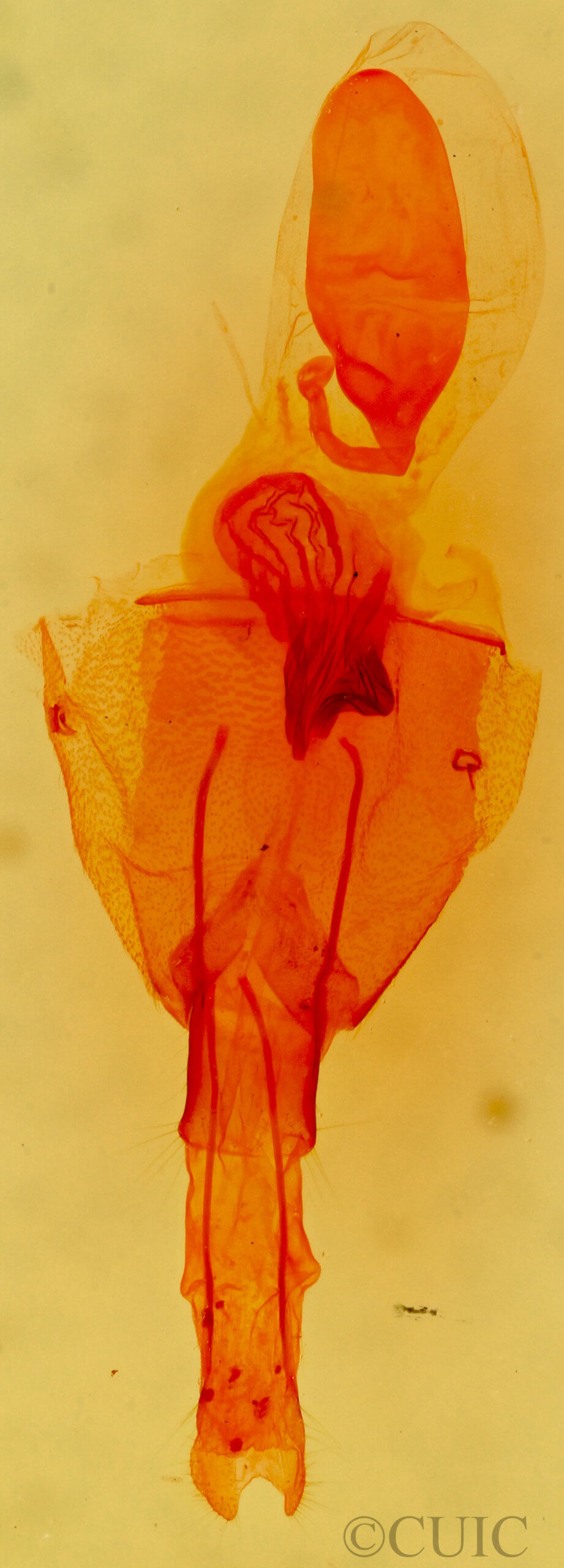 genitalia view of adult Micrathetis triplex