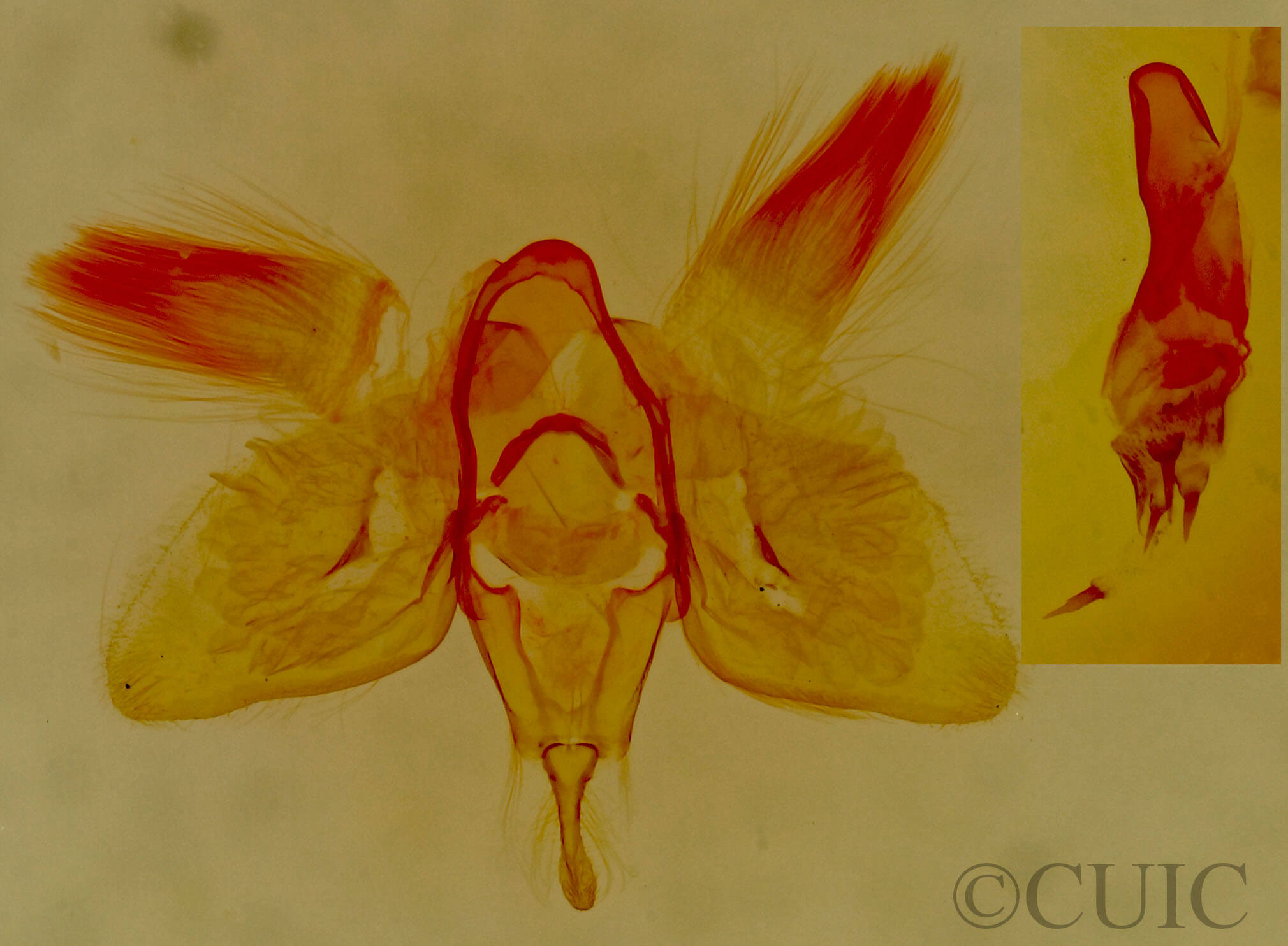 genitalia view of adult Micrathetis costiplaga