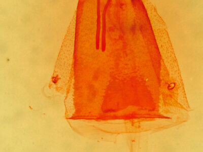 genitalia view of adult Micrathetis costiplaga