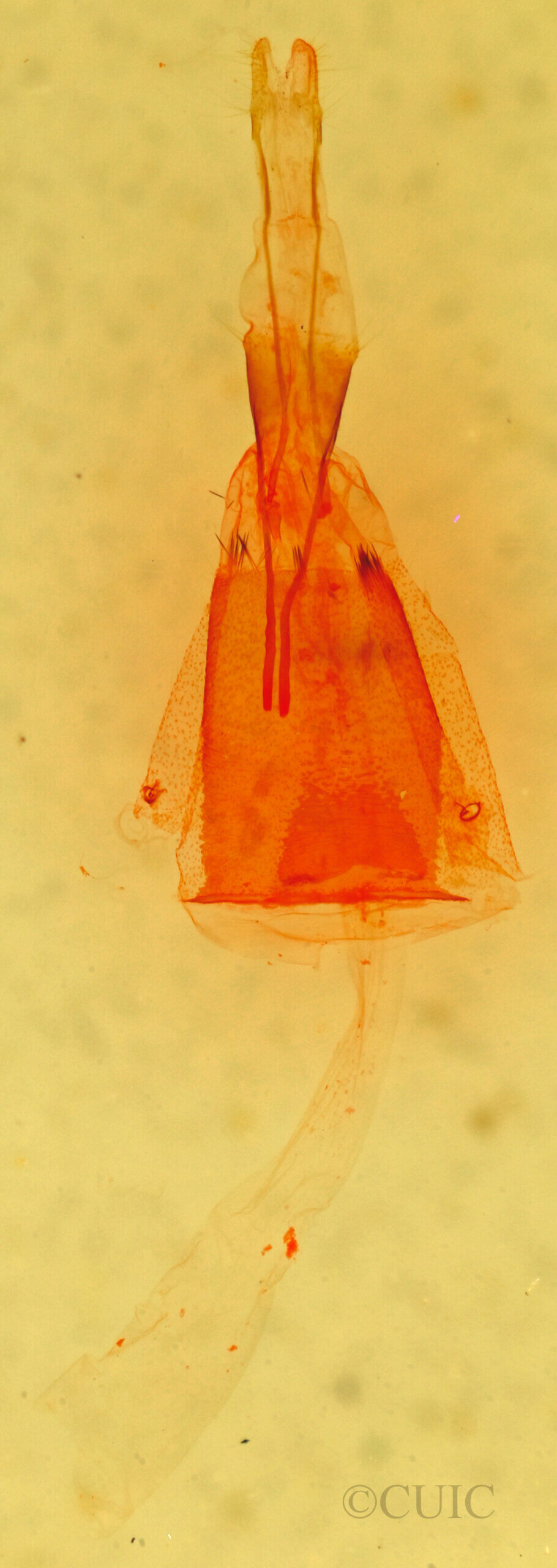 genitalia view of adult Micrathetis costiplaga