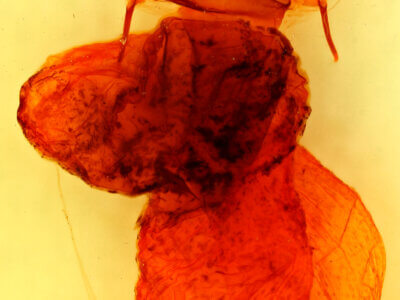 genitalia view of adult Dypterygia caliginosa