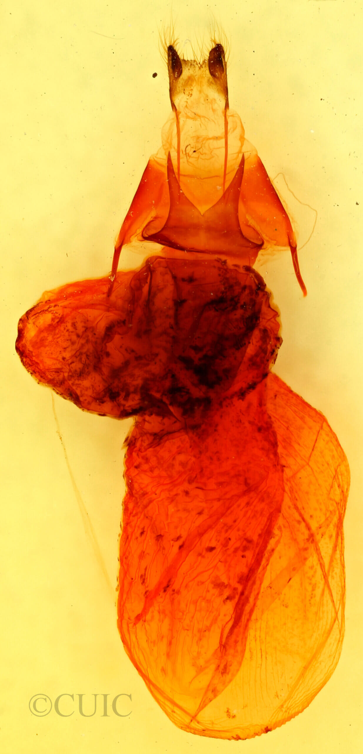 genitalia view of adult Dypterygia caliginosa