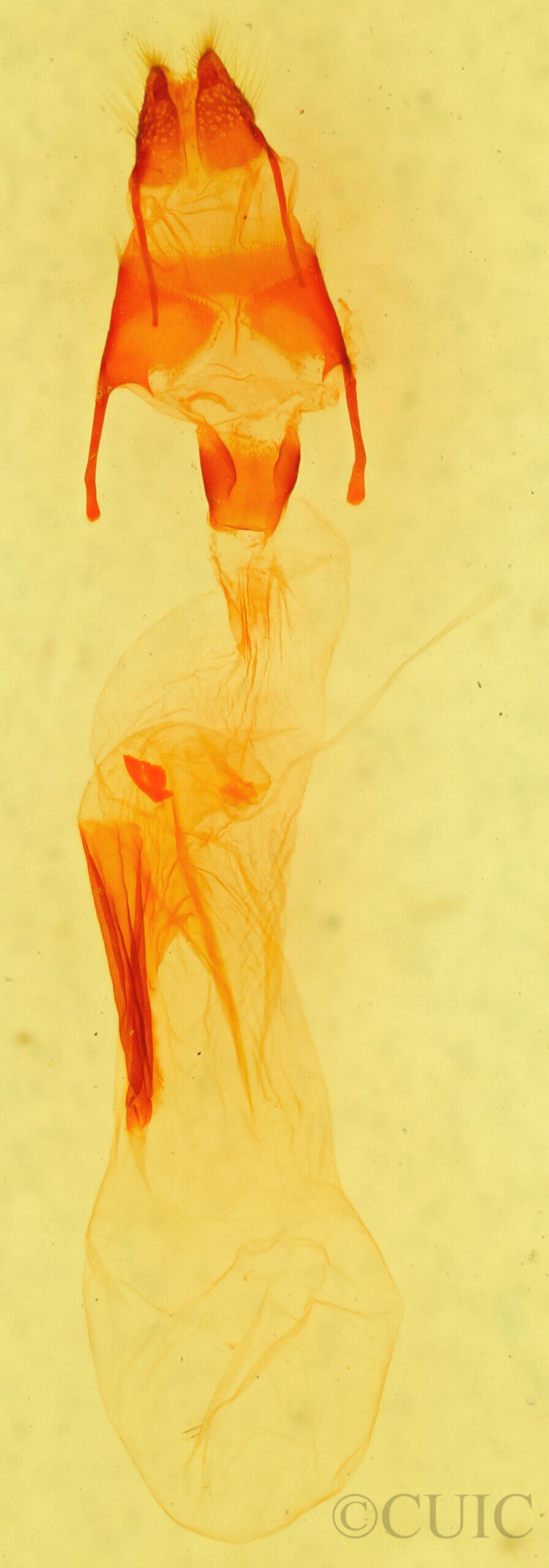 genitalia view of adult Dipterygina sp.