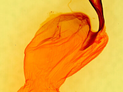 genitalia view of adult Lithophane abita