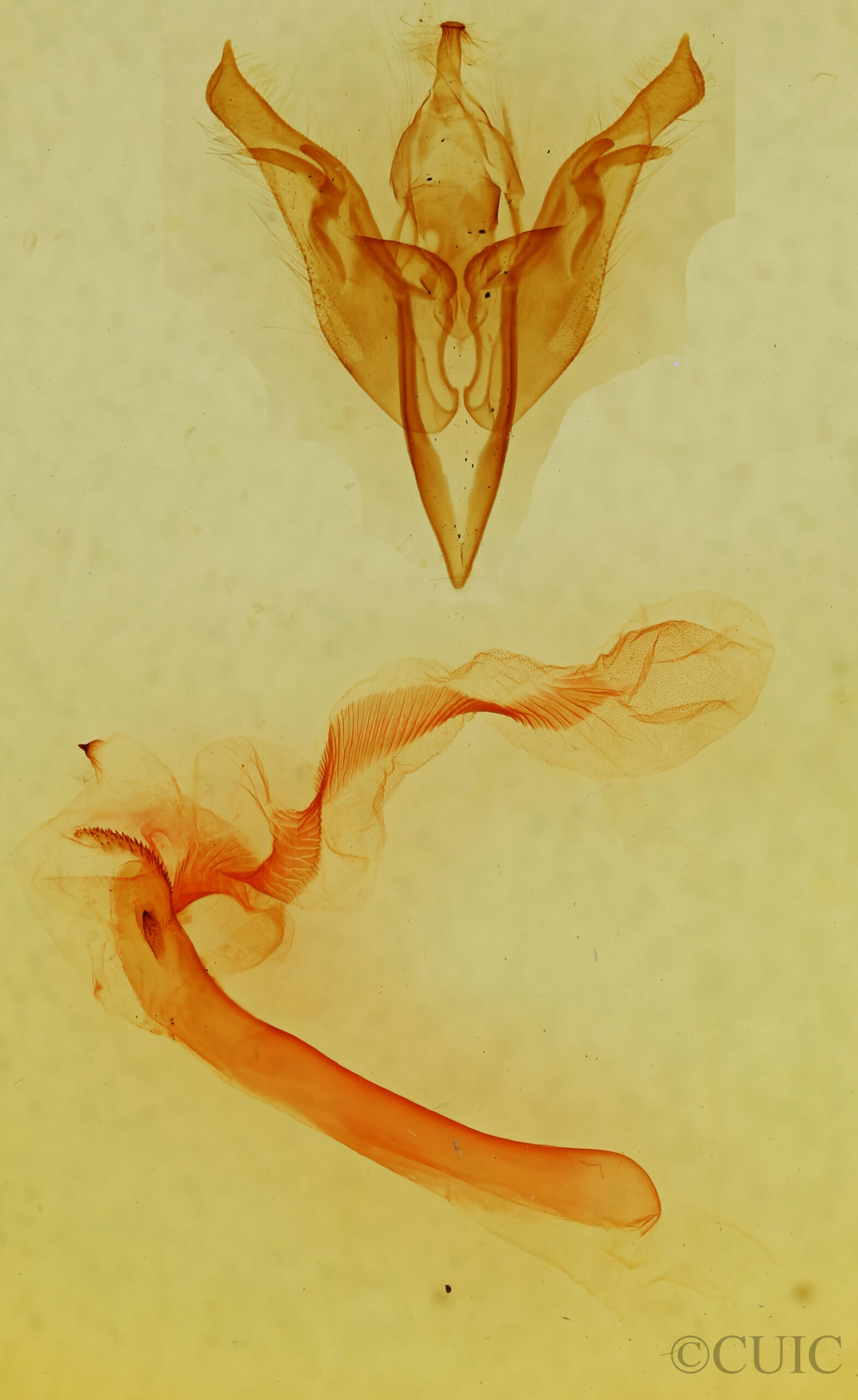 genitalia view of adult Egira variabilis