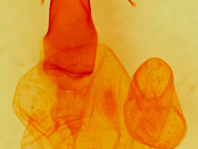 genitalia view of adult Egira variabilis