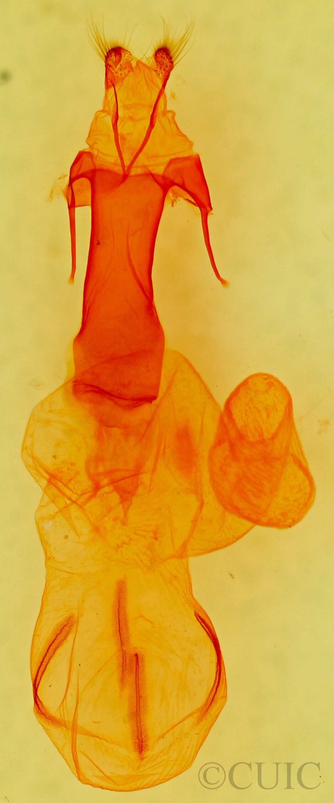 genitalia view of adult Egira variabilis