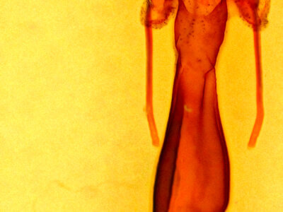 genitalia view of adult Lacinipolia meditata