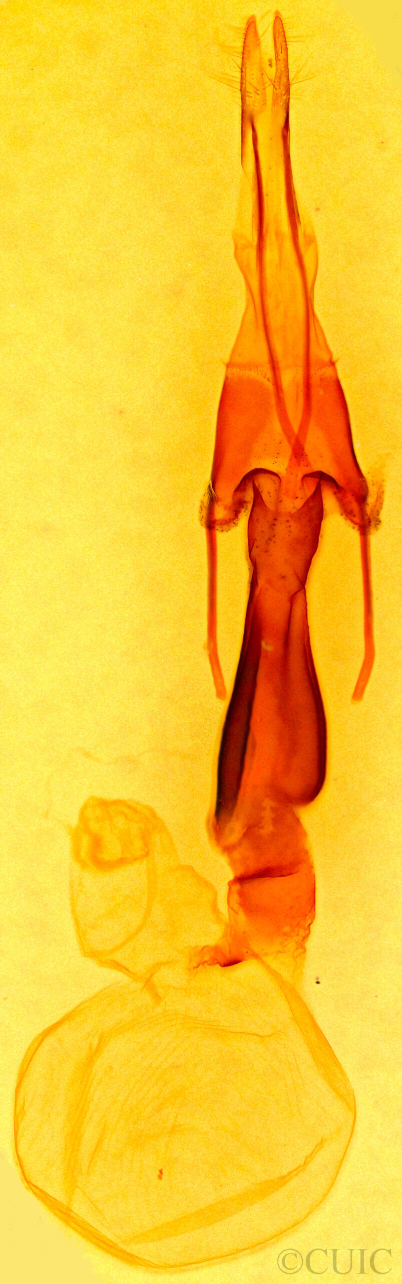 genitalia view of adult Lacinipolia meditata
