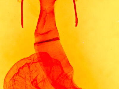 genitalia view of adult Lacinipolia lorea