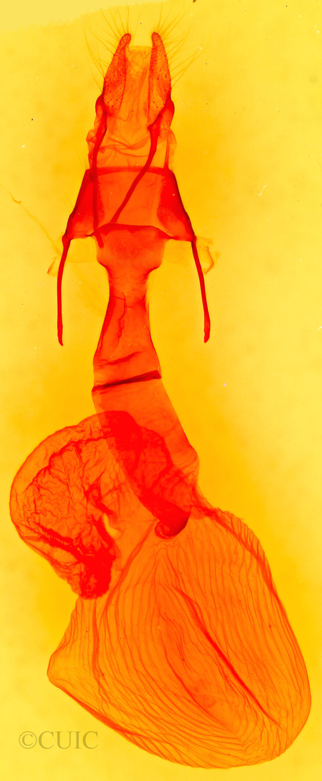 genitalia view of adult Lacinipolia lorea