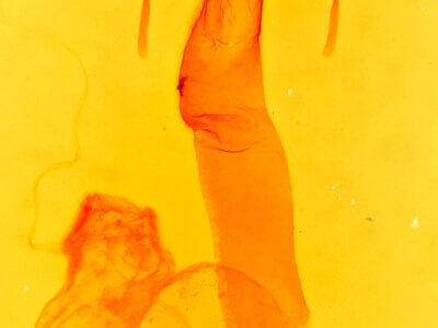 genitalia view of adult Lacinipolia renigera