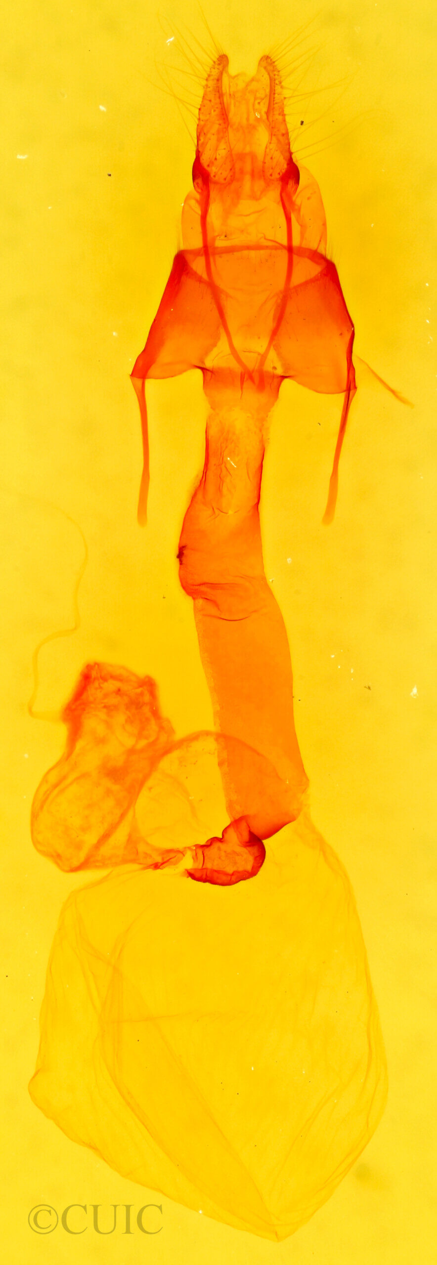 genitalia view of adult Lacinipolia renigera