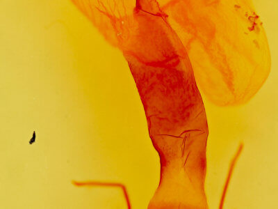 genitalia view of adult Lacinipolia patalis