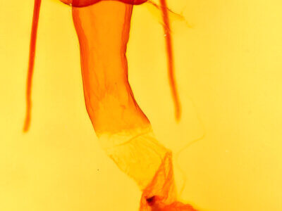 genitalia view of adult Lacinipolia erecta