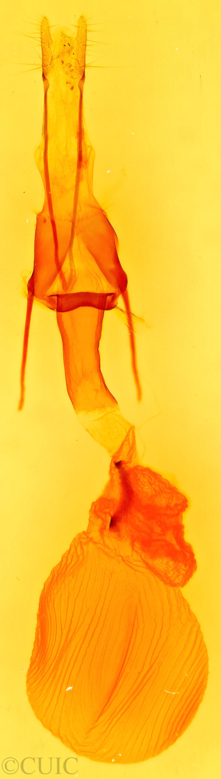 genitalia view of adult Lacinipolia erecta