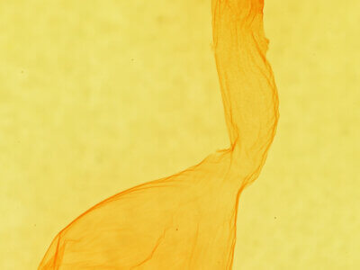 genitalia view of adult Anicla sp.