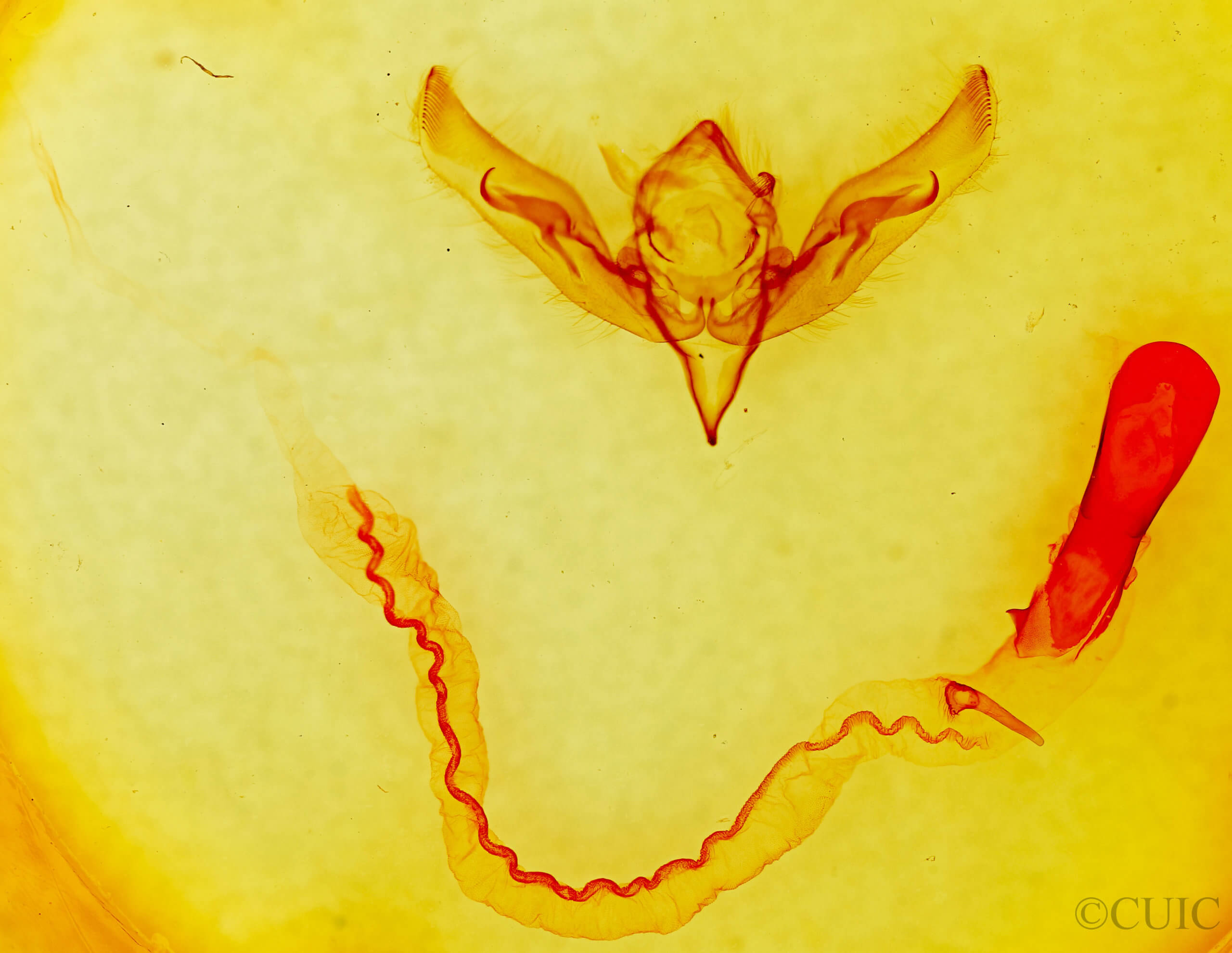 genitalia view of adult Anicla sp.