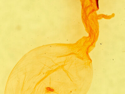 genitalia view of adult Anicla sp.