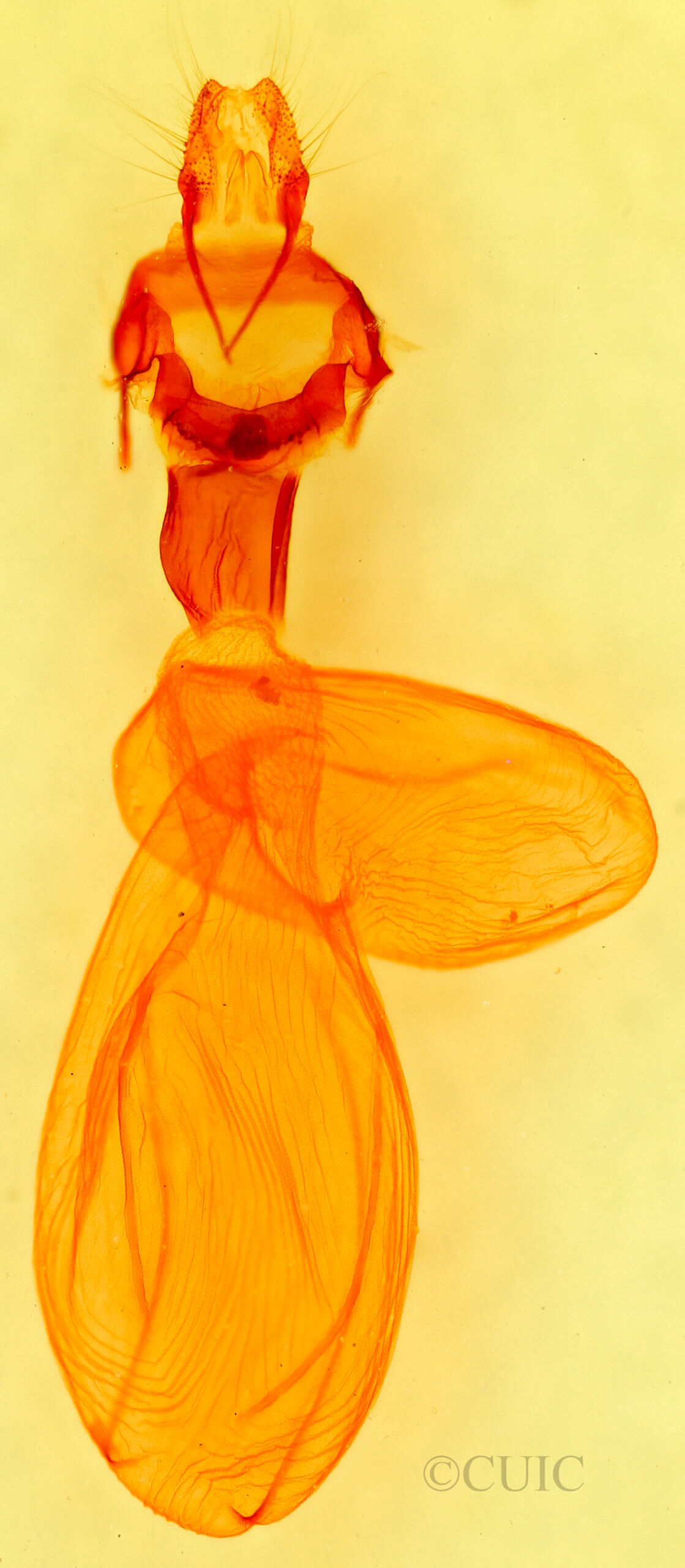genitalia view of adult Xestia bolteri