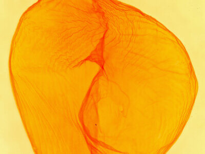 genitalia view of adult Dichagyris triphaenoides