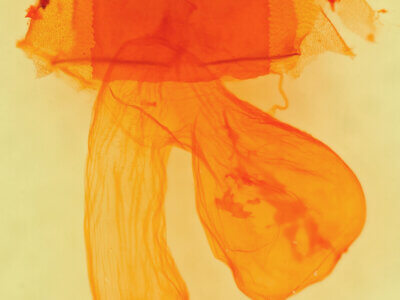 genitalia view of adult Dichagyris lobato