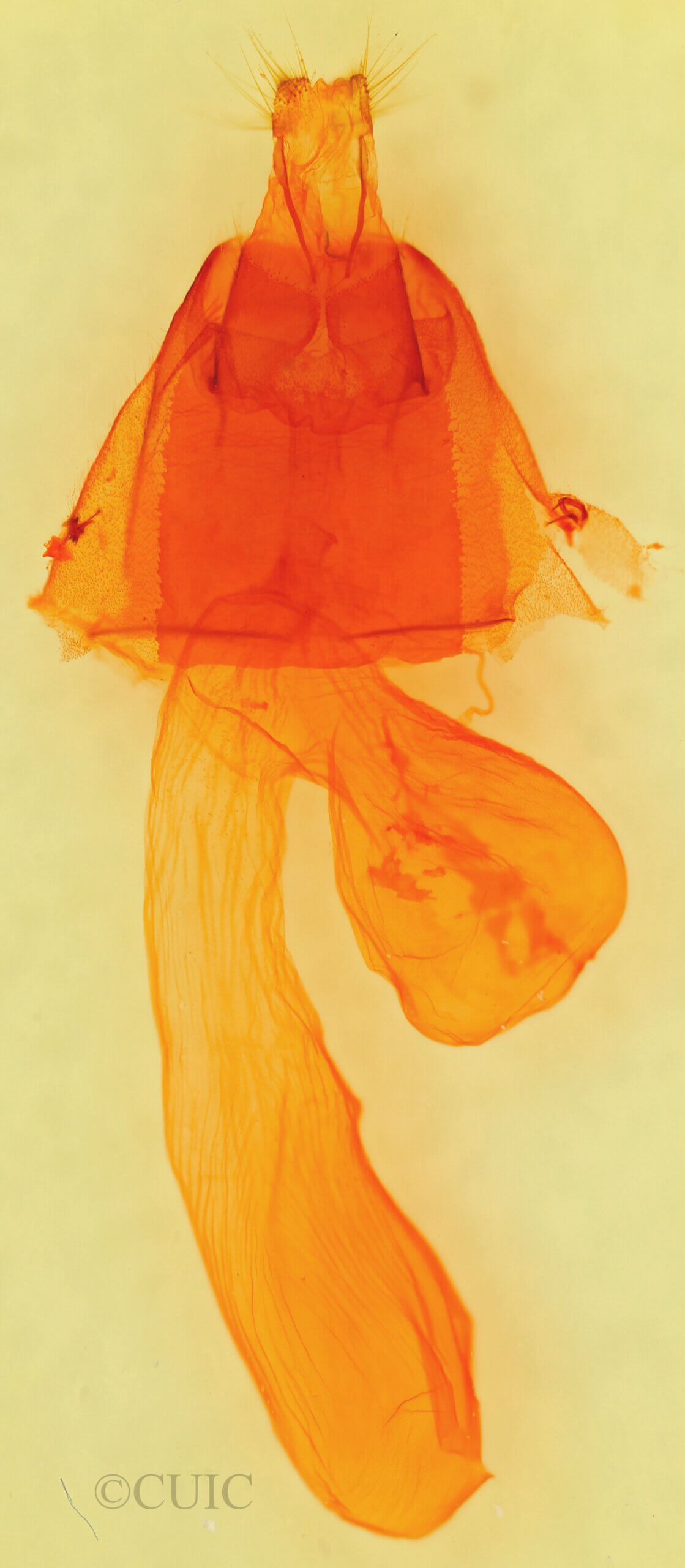 genitalia view of adult Dichagyris lobato