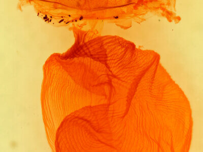 genitalia view of adult Richia chortalis