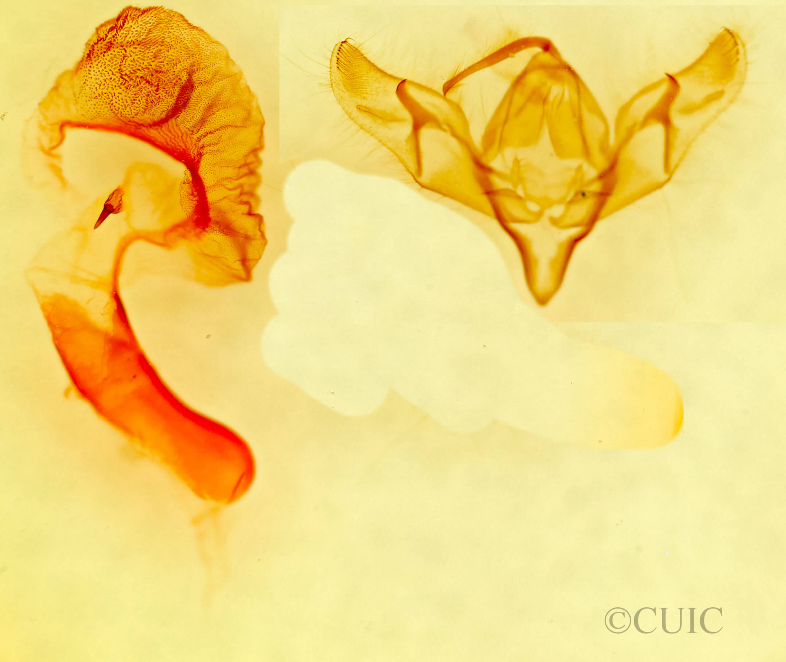 genitalia view of adult Richia parentalis