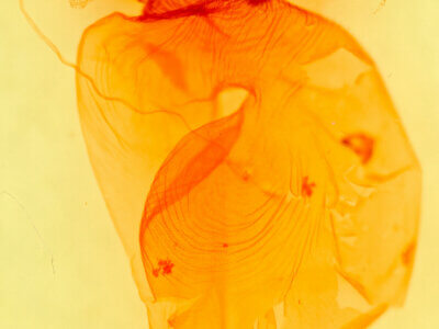 genitalia view of adult Richia parentalis