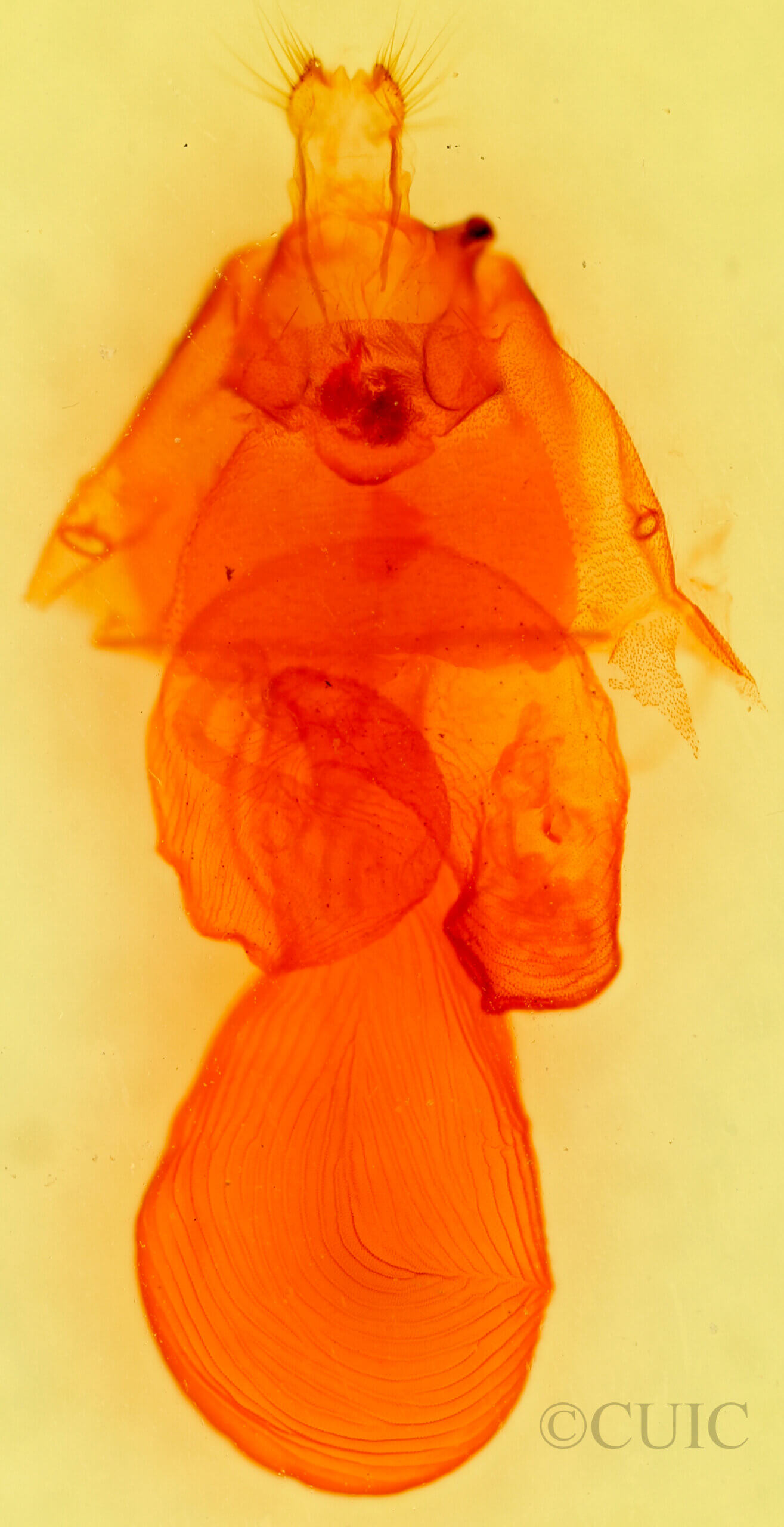 genitalia view of adult Dichagyris sp.