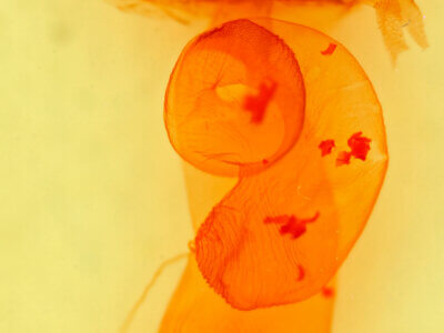 genitalia view of adult Loxagrotis sp.