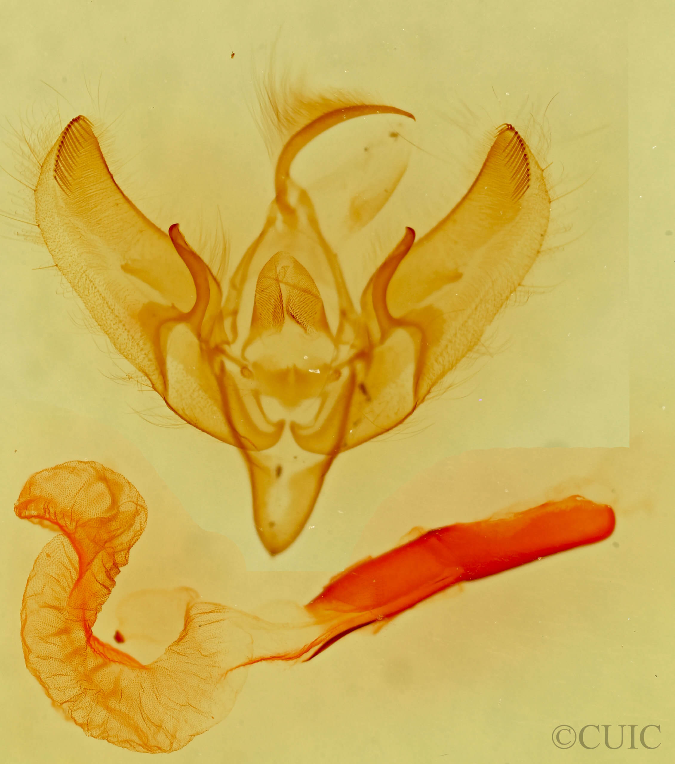 genitalia view of adult Dichagyris salina