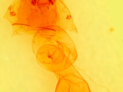 genitalia view of adult Dichagyris salina