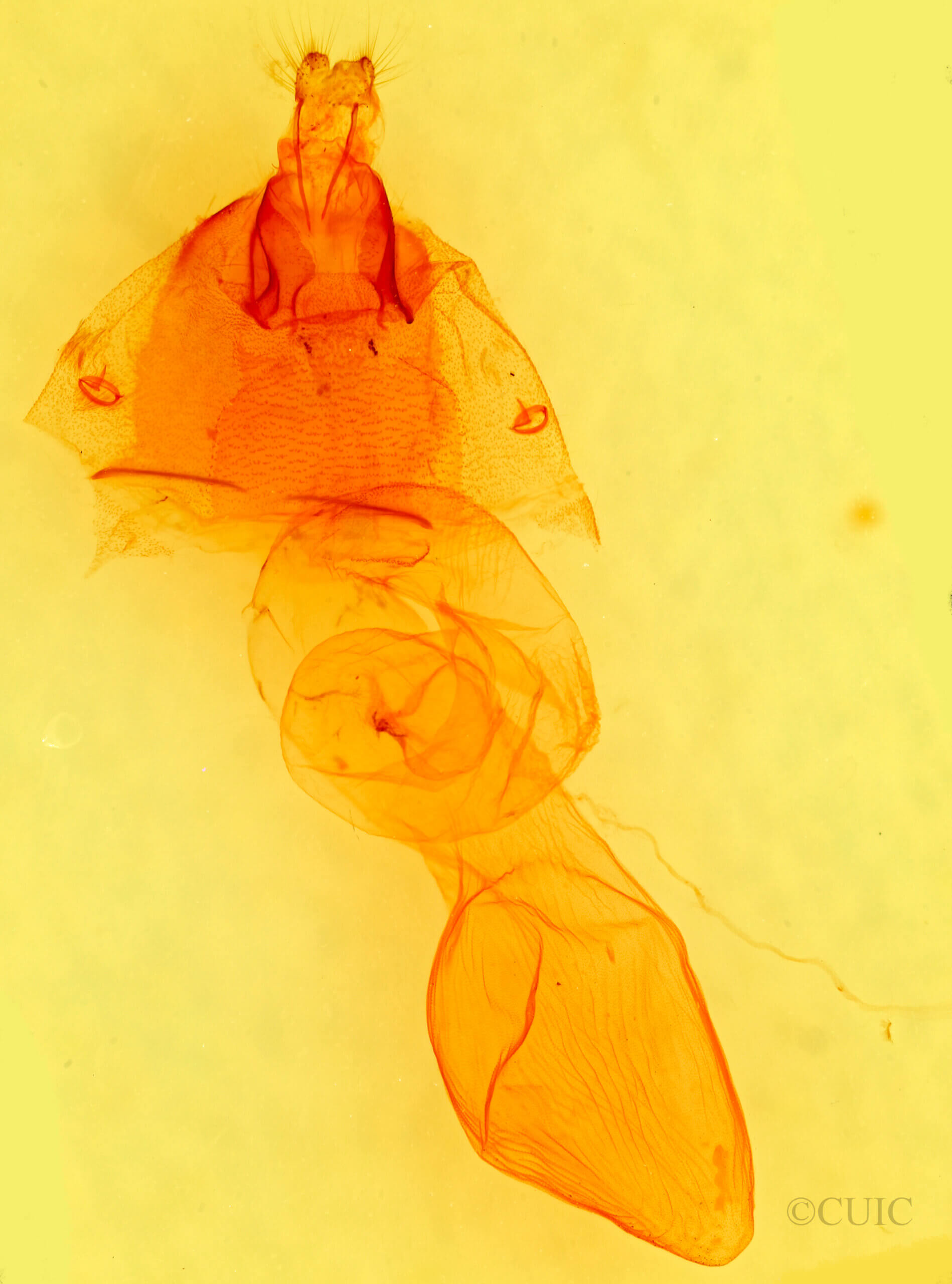 genitalia view of adult Dichagyris salina