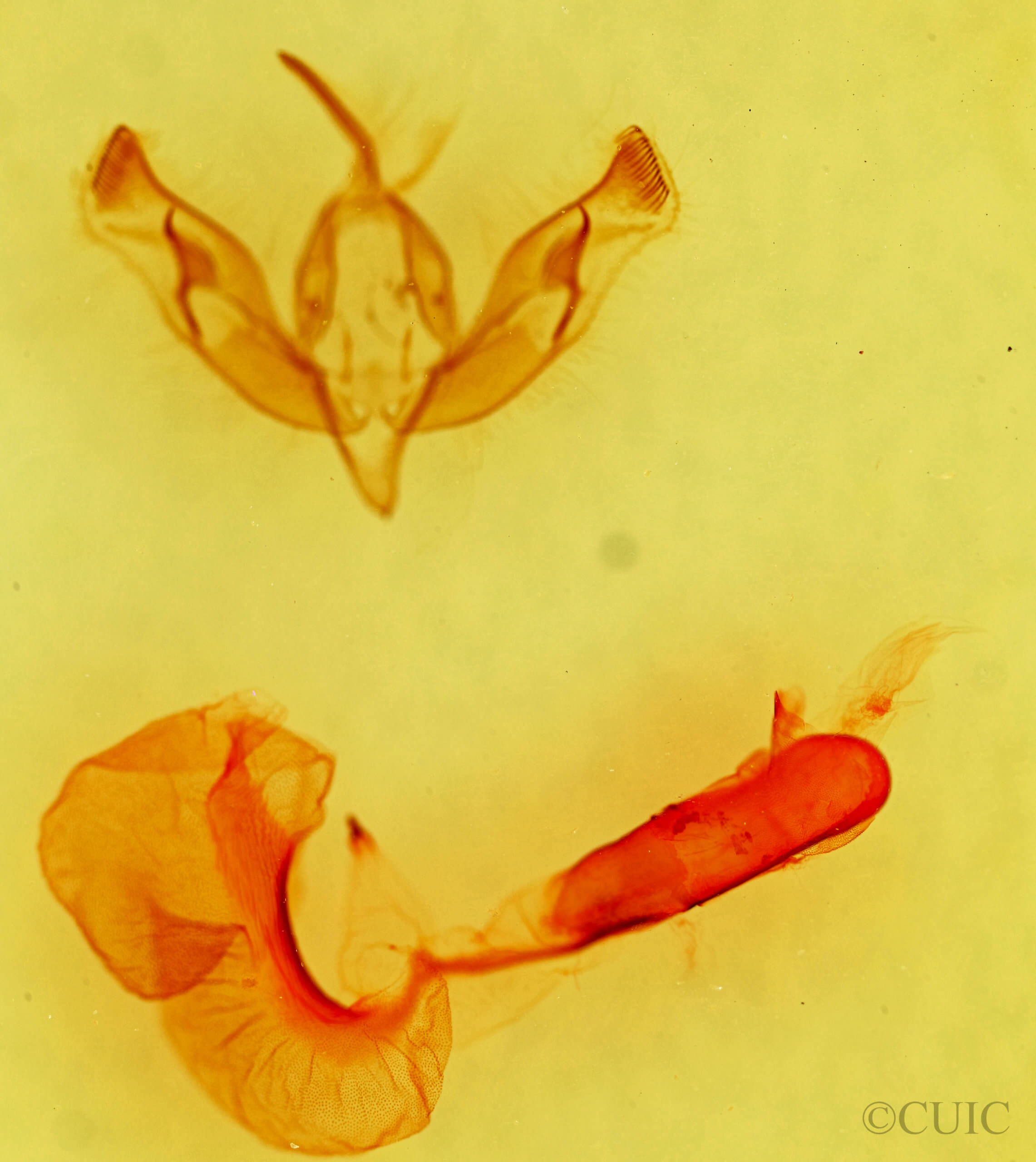 genitalia view of adult Dichagyris capota