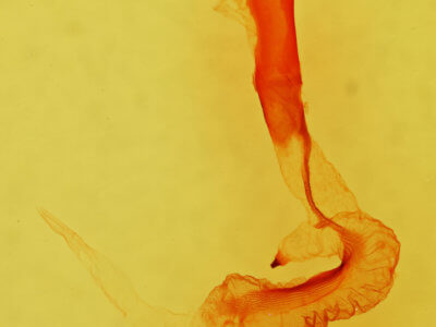 genitalia view of adult Dichagyris capota