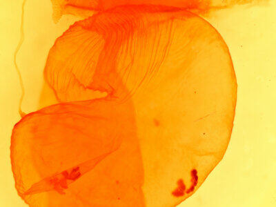 genitalia view of adult Dichagyris proclivis