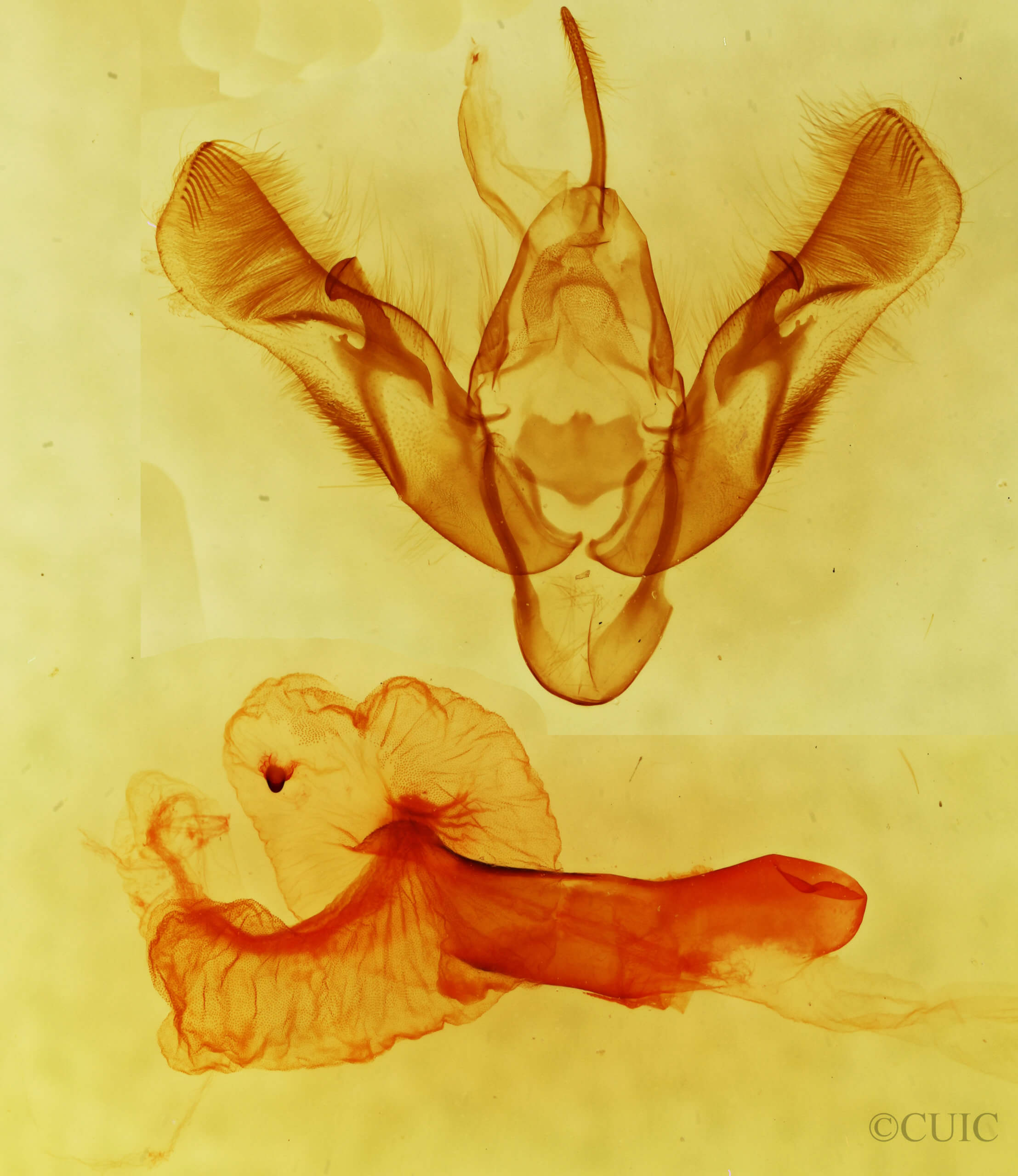 genitalia view of adult Dichagyris acclivis