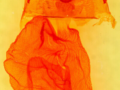 genitalia view of adult Dichagyris acclivis