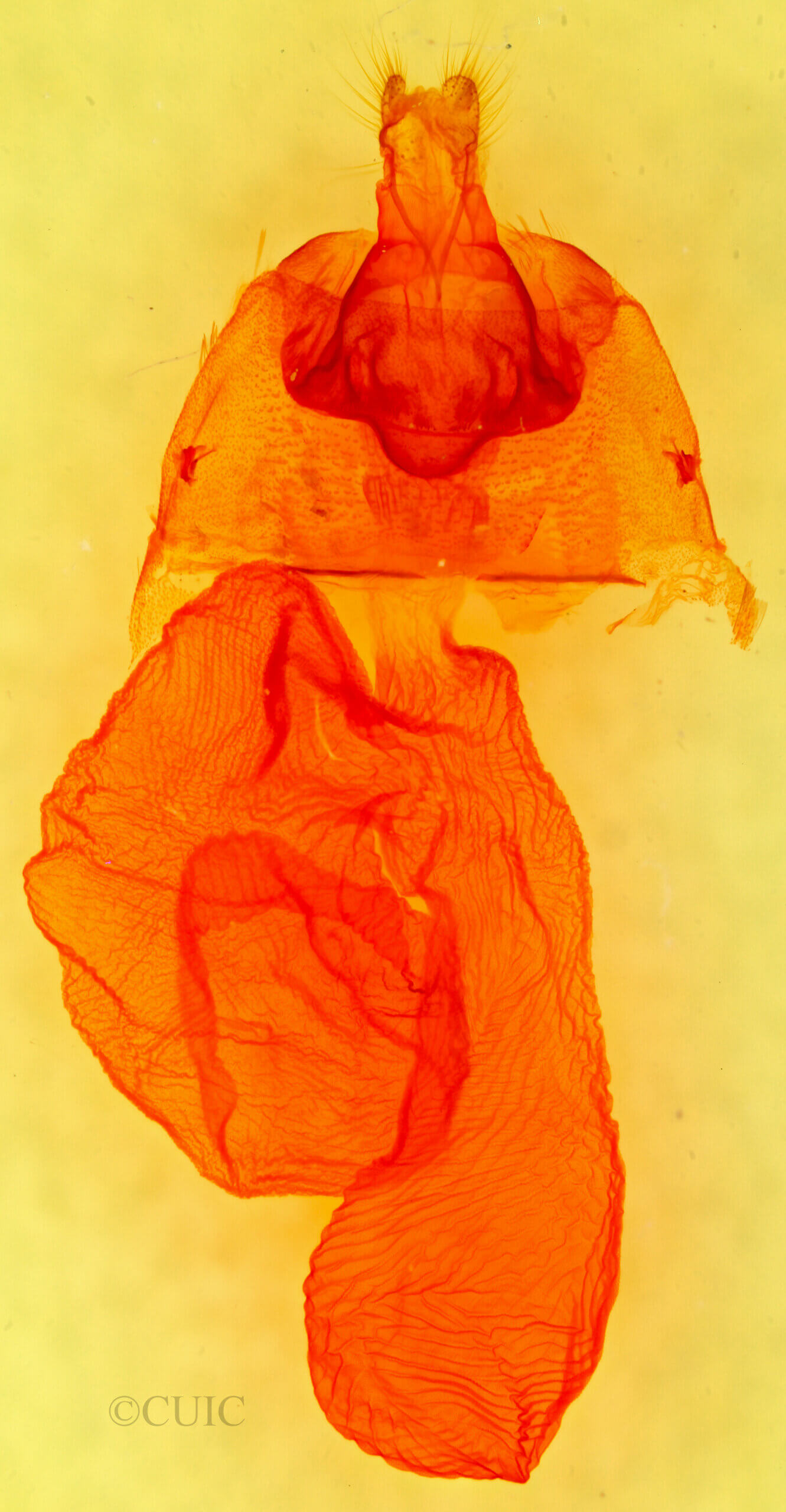 genitalia view of adult Dichagyris acclivis