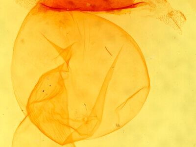 genitalia view of adult Dichagyris capota