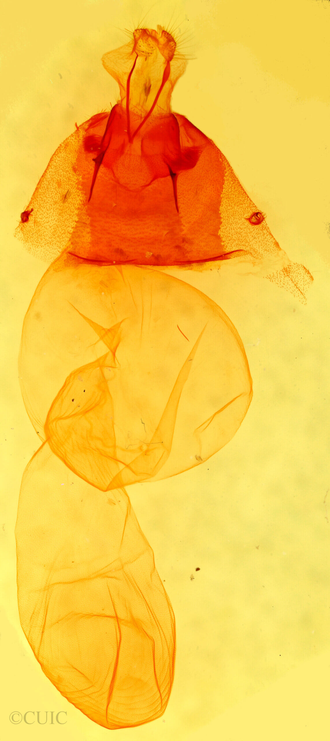 genitalia view of adult Dichagyris capota