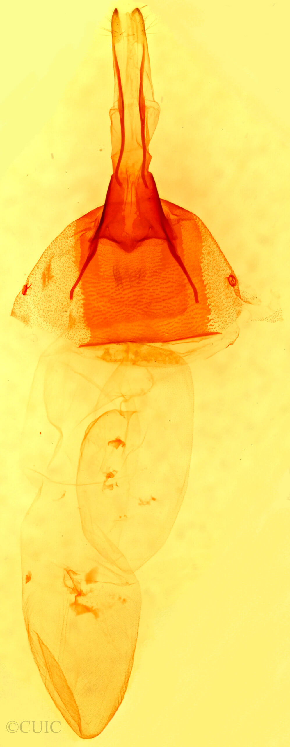 genitalia view of adult Dichagyris grotei