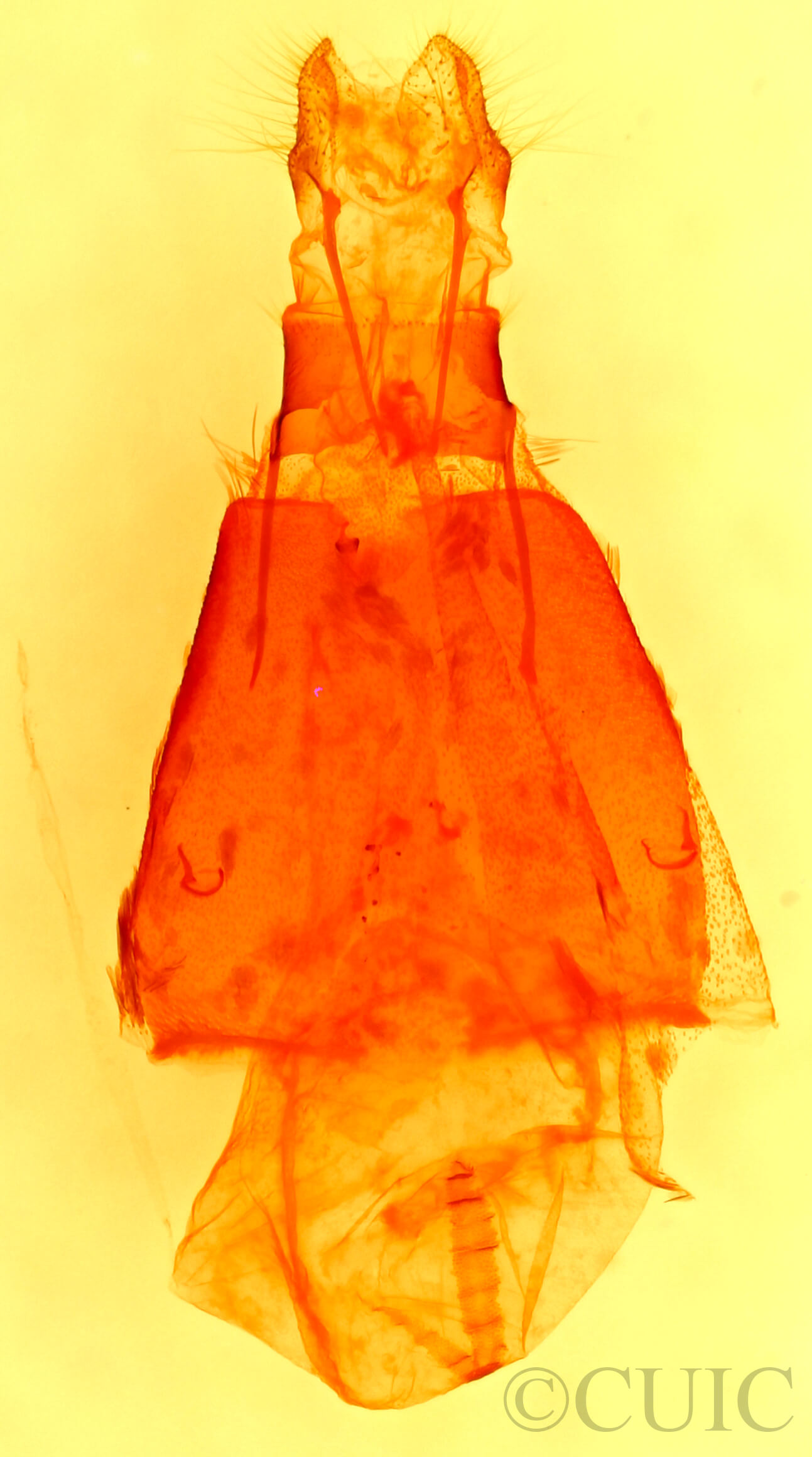 genitalia view of adult Oxycnemis advena