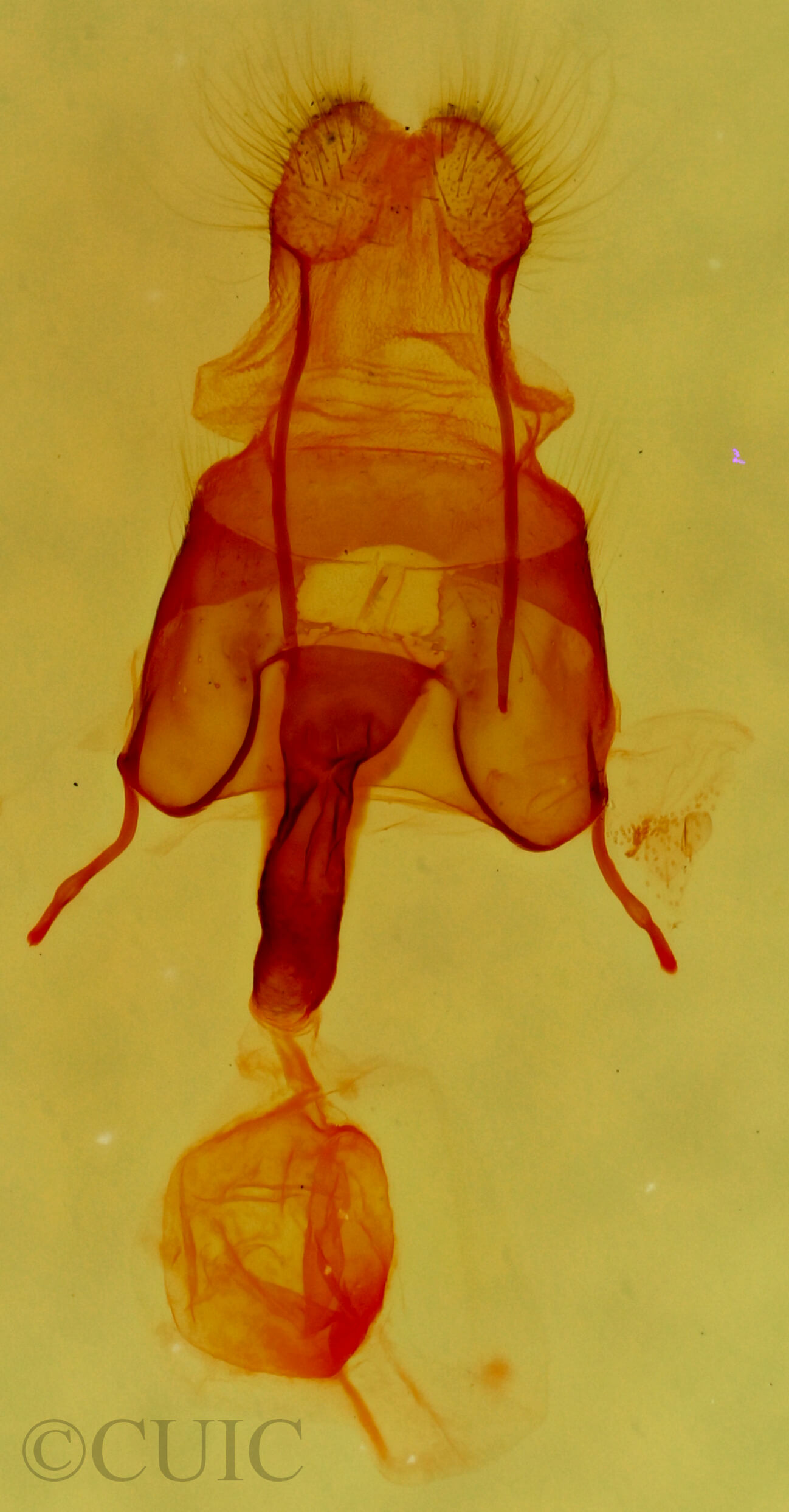 genitalia view of adult Gloanna grisescens